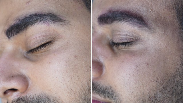 آموزش میکروپیگمنتیشن ابرو
