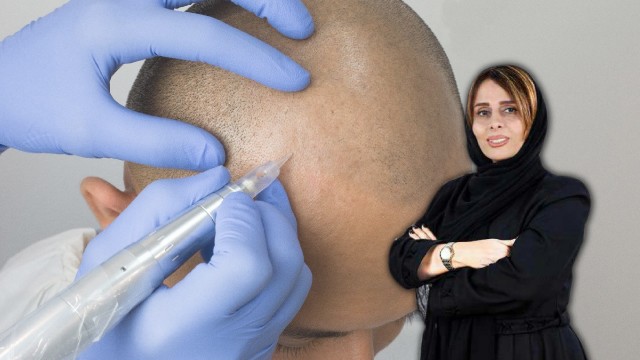 آموزش تخصصی میکرواسکالپ 6 بهمن