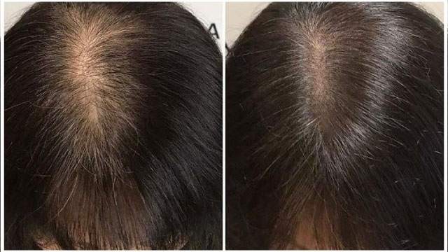 معرفی مرکز تخصصی اسکالپ مو در سعادت آباد